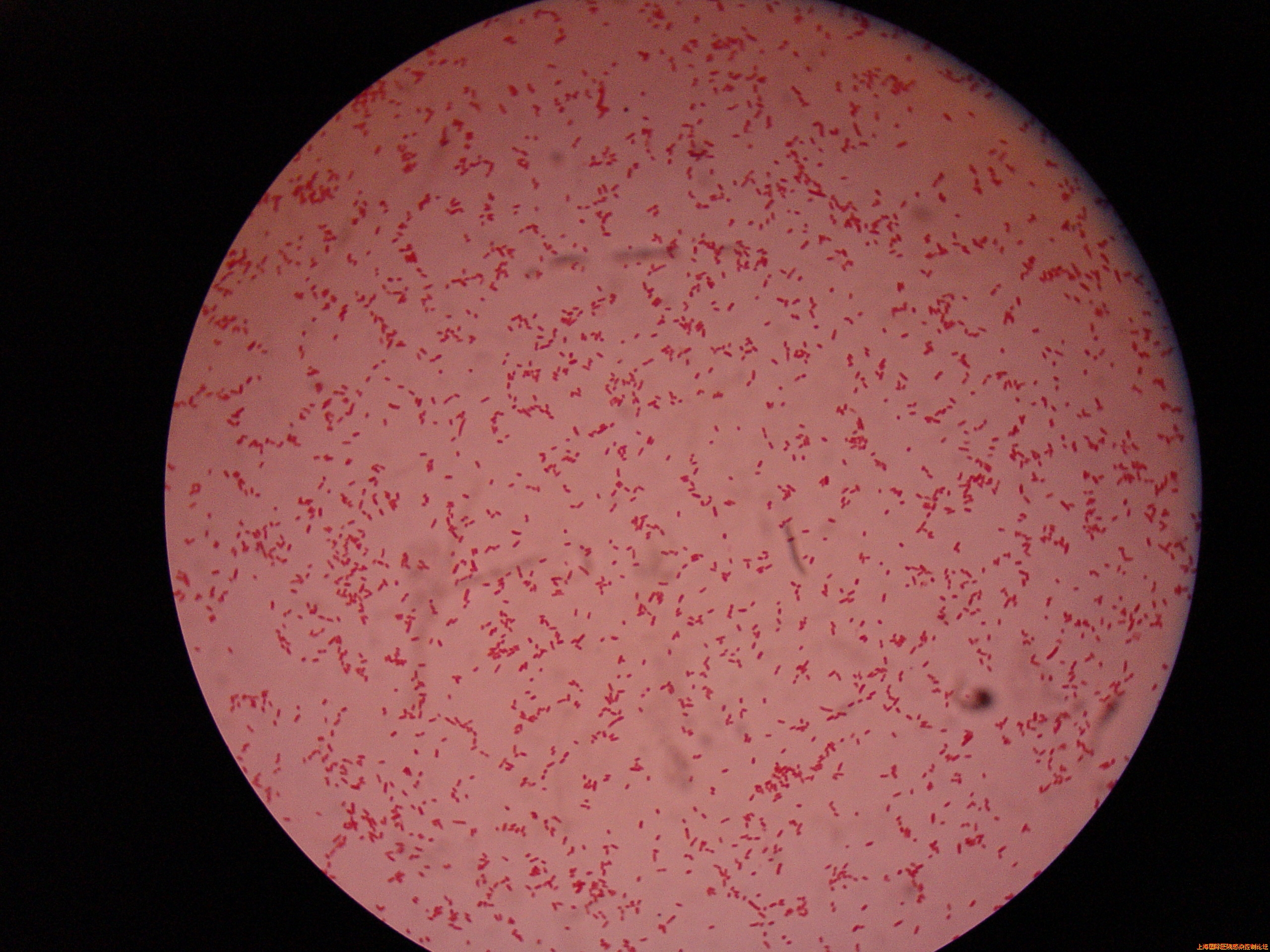 菌落涂片.JPG