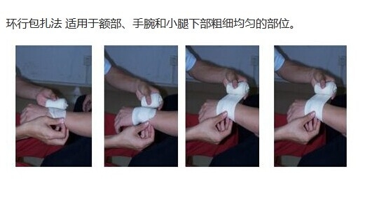 环形包扎.jpg